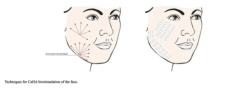 Techniques for CaHa biosimulation of the face